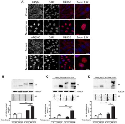 Autophagic and Proteasomal Mediated Removal of Mutant Androgen Receptor in Muscle Models of Spinal and Bulbar Muscular Atrophy